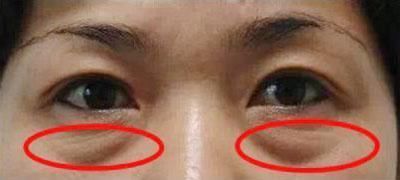 药店墙角一不起眼白色乳液，每晚涂一涂，满脸胶原蛋白