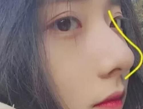  『油脂』鼻子上挤出“白色条状物”？学会这3招，趁早和“草莓鼻”说拜拜