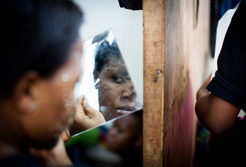 比整容还猛，非洲黑人少女流行把全身漂白