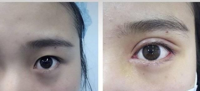  济南@想做双眼皮？先了解这8大误区！济南艺星第五季美杜莎女郎征集中