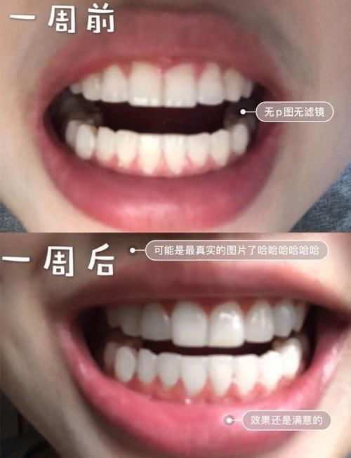 中招@精致的女生这3个地方都很白,有一处发黄都会影响颜值,你中招没