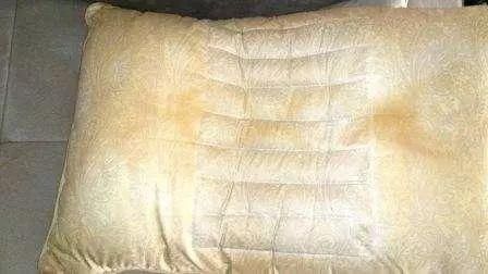 下巴出现这样的‘小痘痘’千万要注意，这是螨虫的真身吗？