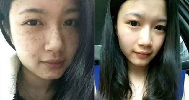色斑总是祛不掉?老中医的美白祛斑法，一招就让黑色素销声匿迹