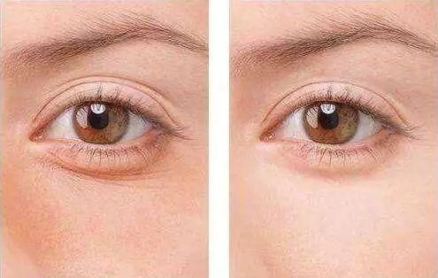 每天喝一点，皮肤就像吃了防腐剂，敷300张面膜可能都比不上...