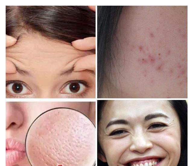  洗面奶@你的洗面奶上黑名单了吗?用了会“烂脸”,小心皮肤越来越差!