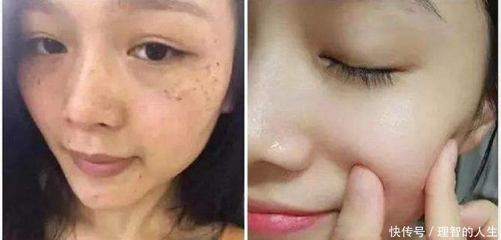  值得■色斑妹子别乱花钱了，用酸奶加它敷脸，美白嫩肤又淡斑，值得收藏