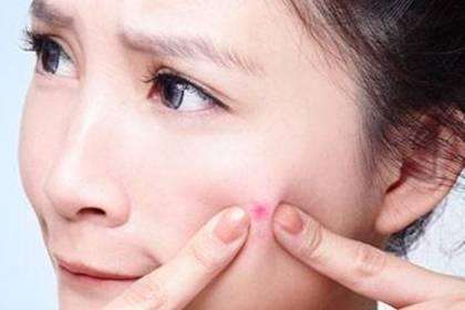 脸上的痘痘没了，留下痘印痘坑怎么办呢?