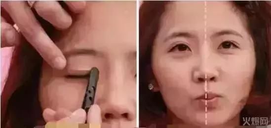 双眼皮贴的三大危害，你知道吗？