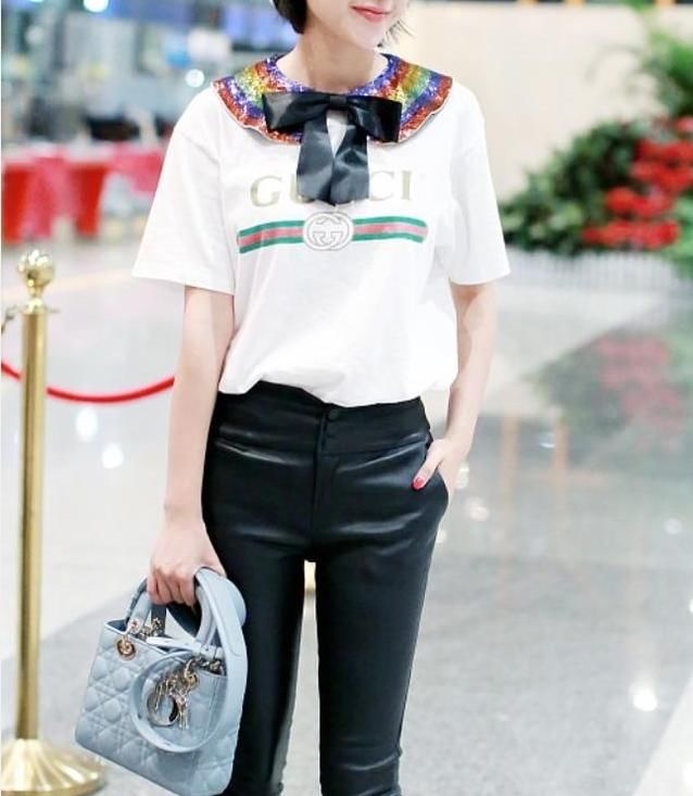 唐艺昕变胖了,穿短裤大腿显粗,然而看见她小腿的绷带我懵圈了!