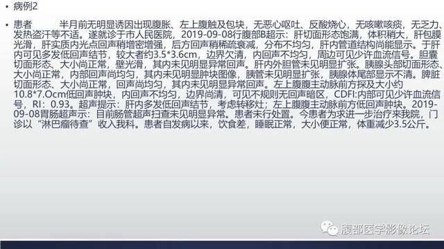  血管穿行@胰腺丨淋巴瘤、孤立性纤维性肿瘤