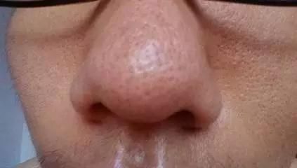 八个错误手法 毛孔突然变大