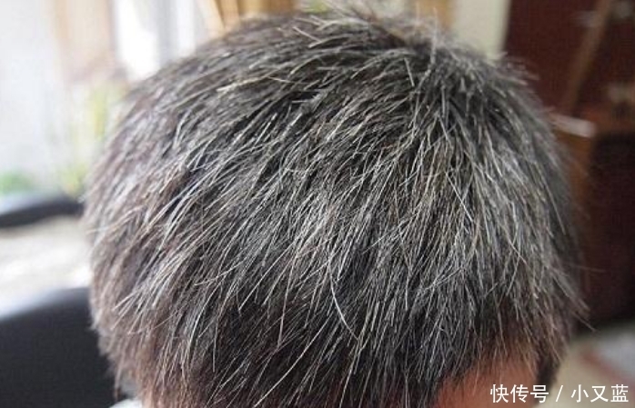  『洗头水』白发不要染,洗头水里放点“它”,坚持一个月,白发慢慢变黑发