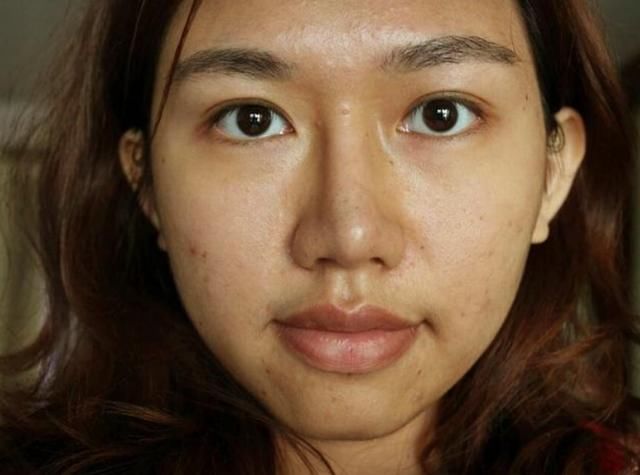 脸上爆痘长黑头，都是螨虫在“怂恿”，2方法快速除螨皮肤变细腻