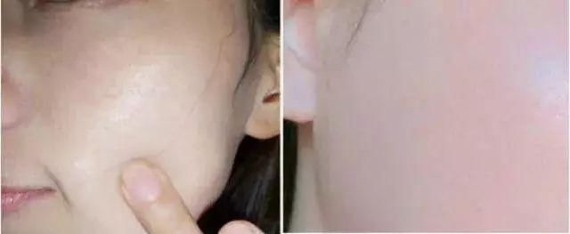 小清新的“脸部吸尘器”，10分钟铲掉你脸上黑头、粉刺、角质!