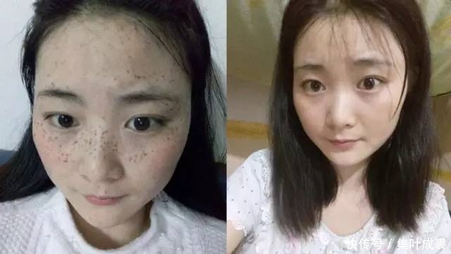 『色斑』牛奶加“它”每天敷脸,快速淡斑又除皱,15天皮肤如婴儿般白嫩