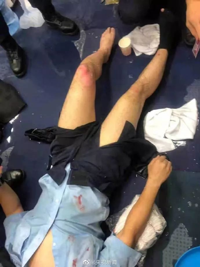 受伤香港警员对暴徒喊话：我们香港警察绝对会果断执法！