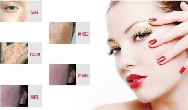 睡前擦一下维生素E，只需10分钟，斑点悄然离去，祛斑比激光还快