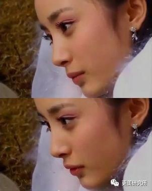 “整牙到底能不能瘦脸”终于有了权威结论，杨幂竟是被冤枉的?