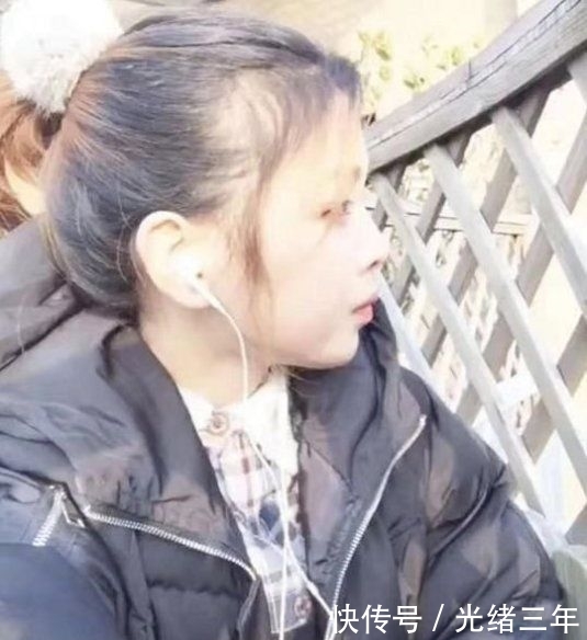 鼻子■鞠婧祎这是第几次do鼻子了?还没消肿就走红毯意外艳压全场!