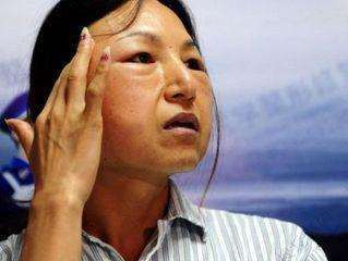 韩国女子整容走火入魔, 丈夫无奈之下只能报警!