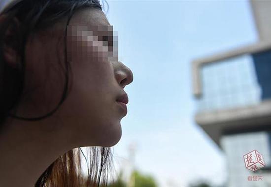 女子贷款3.8万做隆鼻手术 款刚还完假体就快掉出来