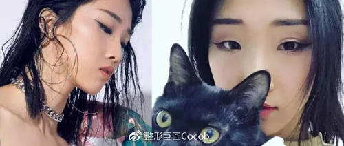 平行和扇形双眼皮该怎么选择？哪个更流行？