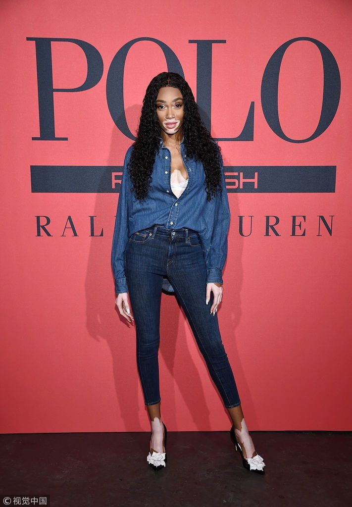 《极盗车神》“baby”埃尔格特帅气现身  白癜风超模温妮哈洛秀事