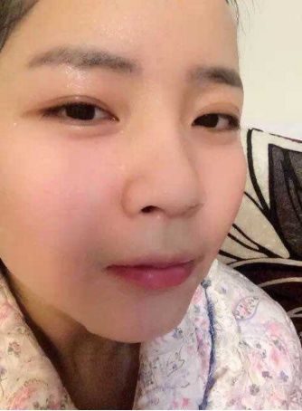 睡前脸上擦一点，一周一次皮肤白里透红，斑点皱纹到六十都见不到