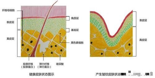  弹性纤维■美人鱼才不会有鱼尾纹，为什么鱼尾纹会找上我们