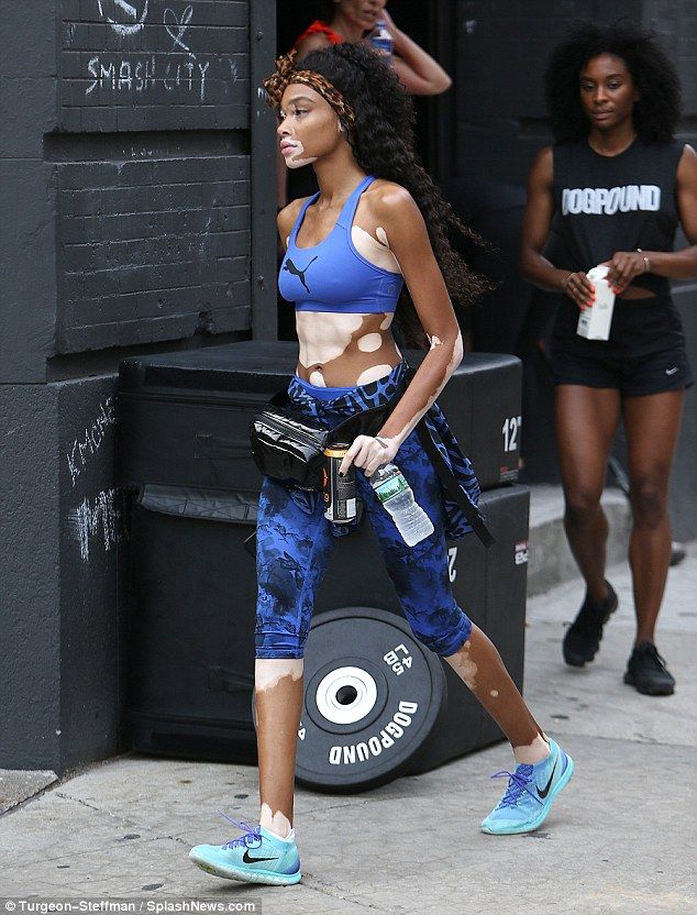 街拍白癜风超模WinnieHarlow，另一种的性感和自信