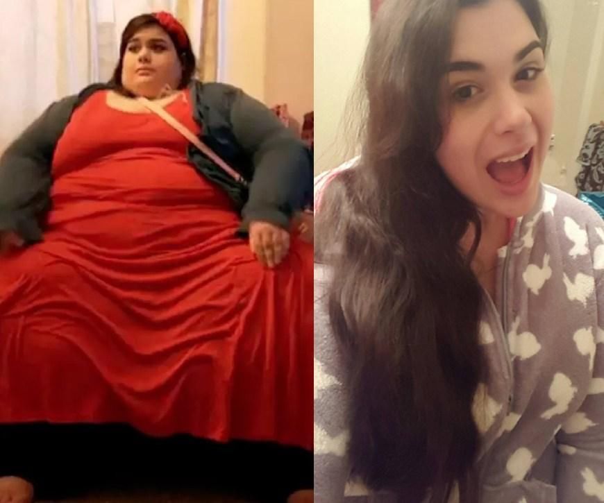 她从体重600斤到200斤，原来，肥胖会遮住一个人的美！