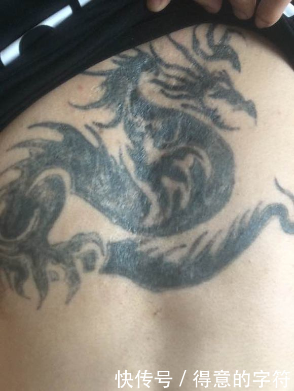洗纹身行业：新科技引领去痕变革