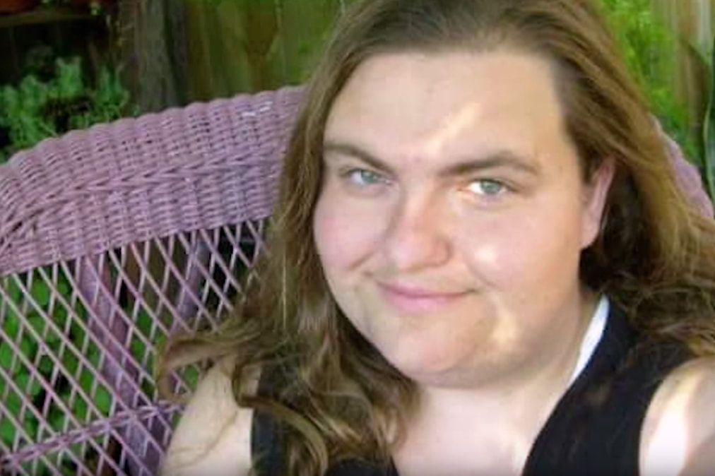 蓄起胡子留起了体毛，身患怪病的她让自己变得更有魅力了