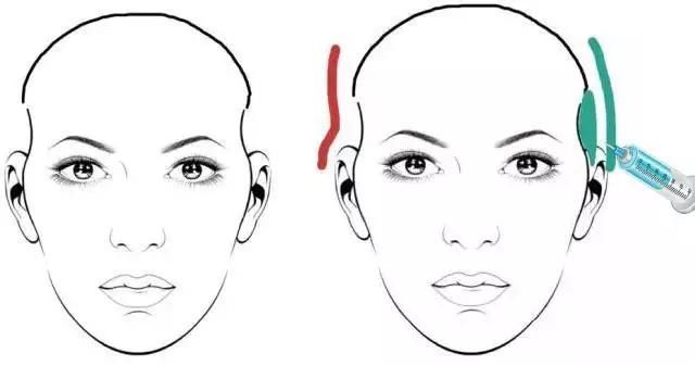 太阳穴凹陷,是不吉面相,老公跑得快!这样做可以挽救