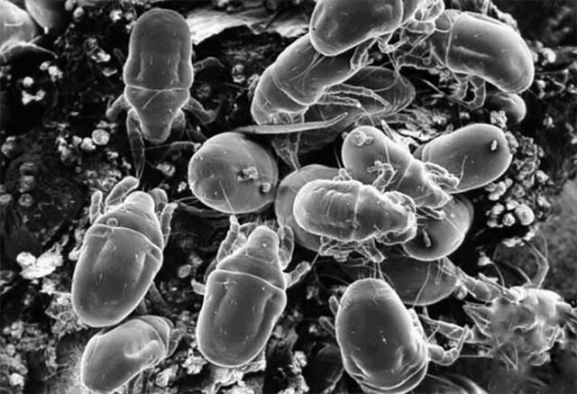 皮肤变成螨虫窝竟浑然不知，3方法教你自检，十试九中2招根除