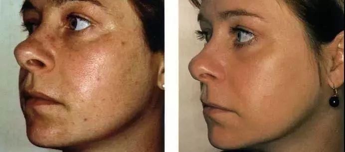 张韶涵又双叒叕种草了!10秒洗出角质、死皮，温和去角质...