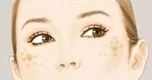 胶原蛋白成■斑点的形成因素，你中了哪几招？