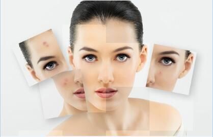 果酸换肤，让肌肤焕然新生