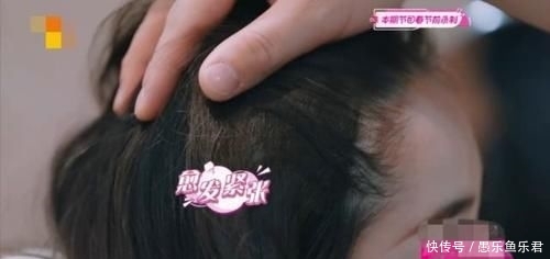 急需■蒋梦婕脱发严重!发际线真的高出天际,急需植发补救