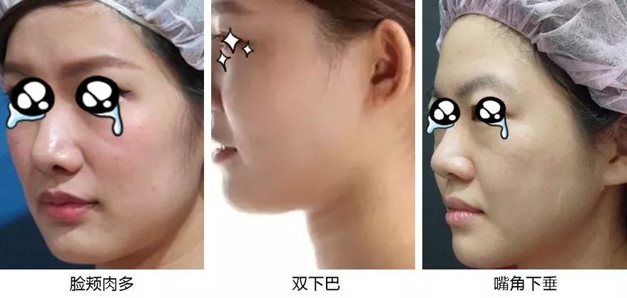 今年最火的“缩脸短发”，让脸小到不行