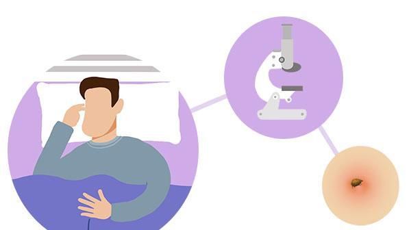  【小圆点】鼻翼两侧挤出的白色分泌物是什么?越挤越多,教你方法清理