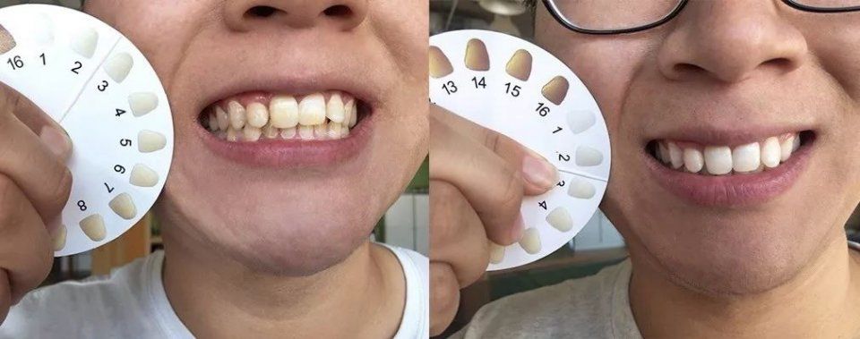 为什么新垣结衣们笑起来那么好看?