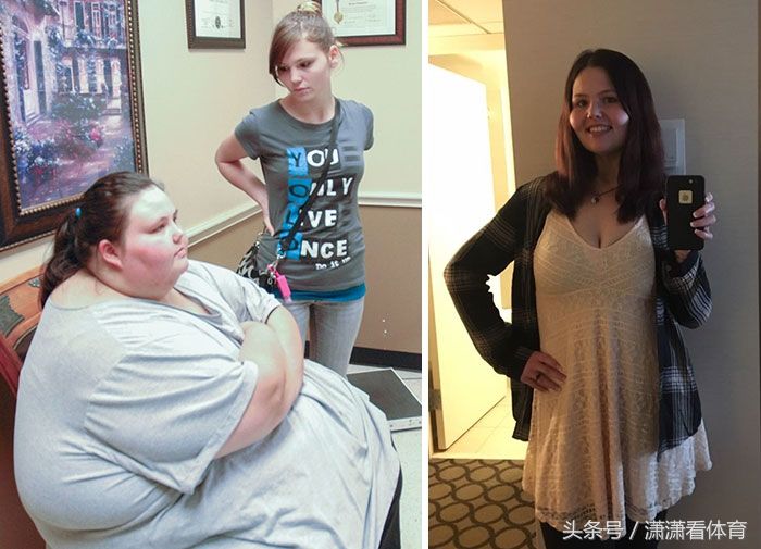 这群体重超过500斤的人仍回归正常，减肥堪比整容!