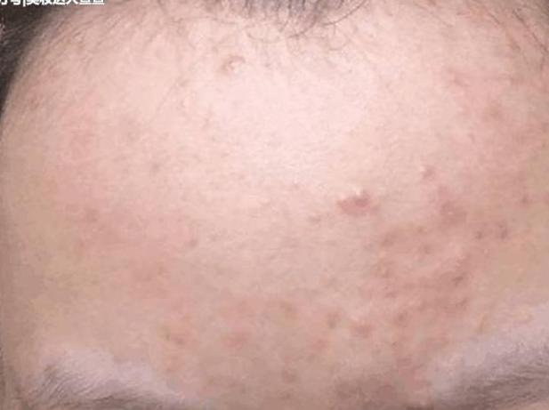 毛孔粗成坑到处都是洞,每天睡前坚持1件事,紧缩毛孔又小又细