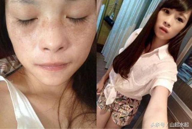 阿司匹林和软膏完美结合，30天后皮肤嫩了脸蛋白了心情自然好了