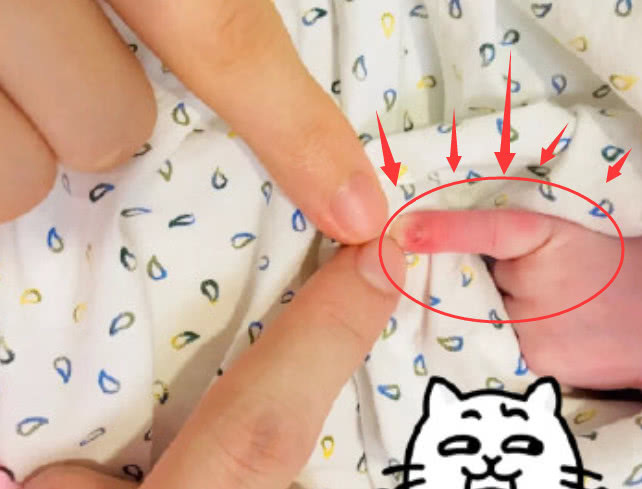 ?网友晒“掰手指”后果照，怒批薛之谦拿孩子炒作：不配当父母！