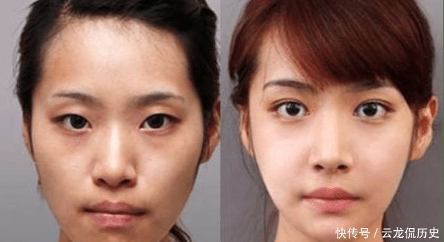  「答案」割了“双眼皮”的人, 等老了之后会变成什么样 答案你可能想不到