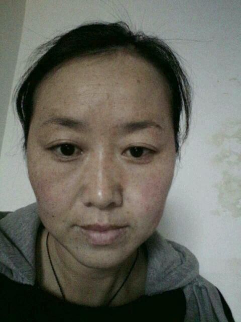 香蕉皮加点它祛斑，涂抹7天之后，36岁阿姨皮肤白嫩到完胜小姑娘