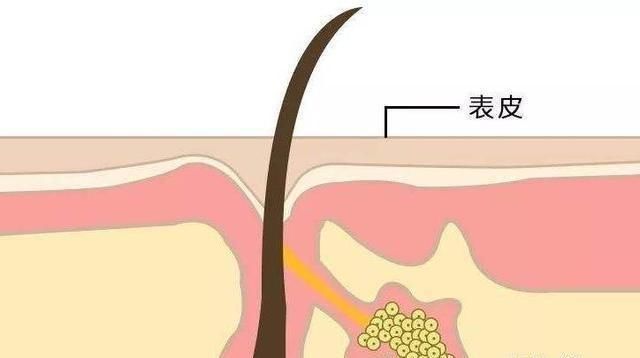 『毛孔粗大』女生这个部位越“大”,看起来就越老,五官再美也无法拯救