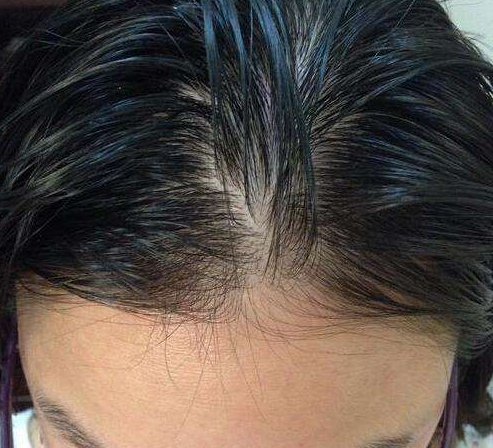  油脂：一天不洗头发，就变得很油？这些油到底是从哪里来的？